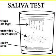 Kuna vale menüü, stressi, ravimite ja teiste kaasaegsest elust tingitud teguritega seoses on  paljudel inimestel soolestiku mikrofloora tasakaal häiritud, pakun välja kergelt teostatava pärmseene testi. Kodust kandidoosi testi tehakse hommikul. Kohe peale ülesärkamist ja enne hammaste pesemist, laske läbipaistev klaas vett täis ja sülitage sinna sisse (kui teil on huvi seda katset läbi viia, kuid kipute hommikuti unustama, […]