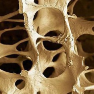 Probleemid luude kvaliteedi ja tihedusega (osteopeenia ja osteoporoos) on muu hulgas tugevalt seotud kroonilise stressi, veresuhkru tasakaalutuse ja ülekaaluga. Teisisõnu, tegu on ainevahetuse ehk metaboolse tervise hälbimisega seotud vaevustega. Õlgu väristama panev statistika ütleb, et Eestis põeb osteoporoosi iga kolmas üle 60. aastane ja iga teine üle 70-aastane naine. Kõrge stressihormoonide tase stimuleerib organitevahelise vistseraalse […]